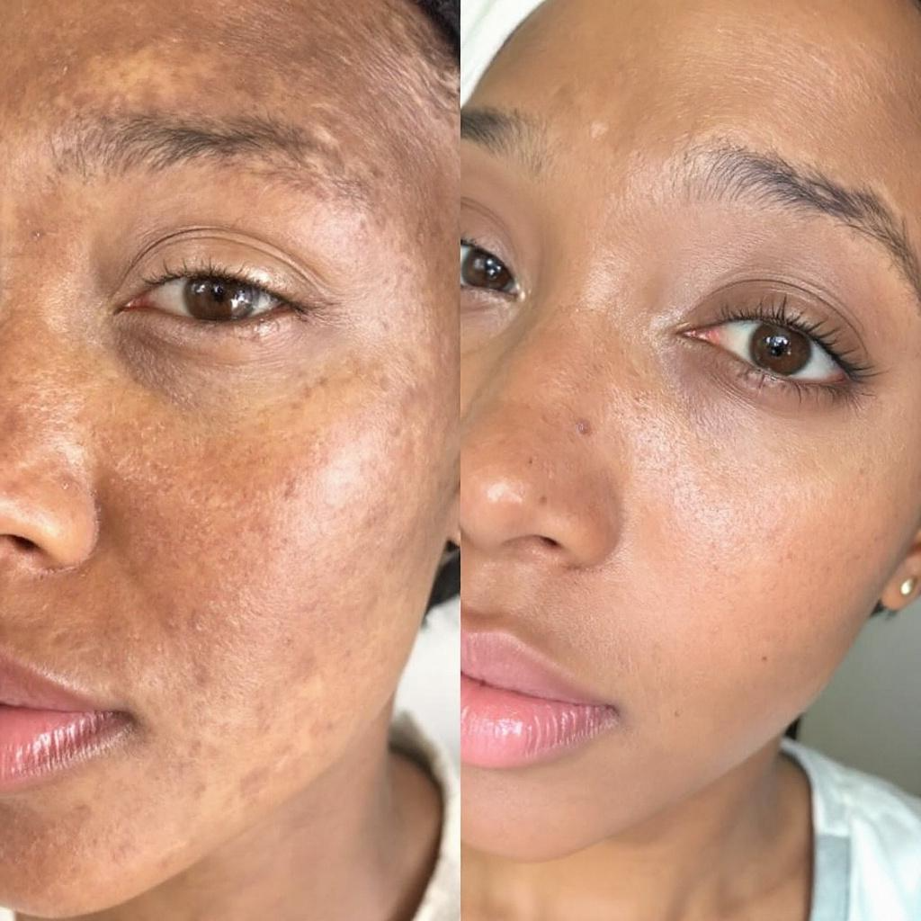 Turmeric & Green Tea Repair Face Serum