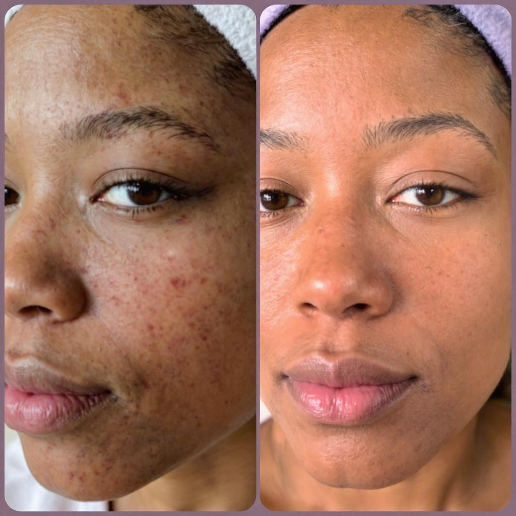 “Radiance Ready” Turmeric & Green Tea Face Cleanser
