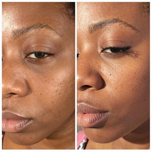 Superfruit Hydrating & Brightening Facial Serum