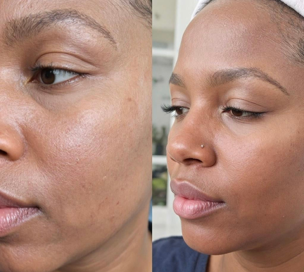 Superfruit Hydrating & Brightening Facial Serum
