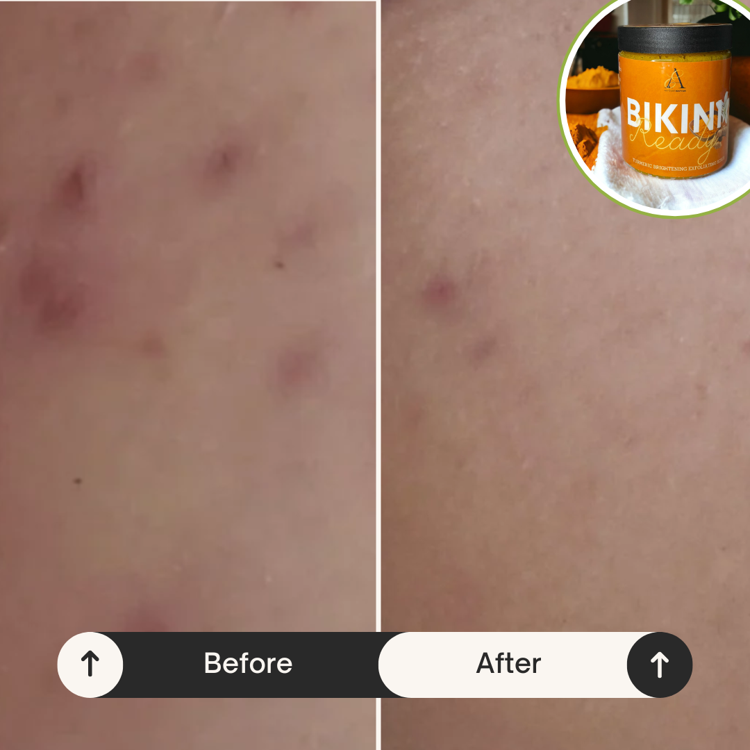 “Bikini Ready” Turmeric Fading & Brightening Bikini Scrub
