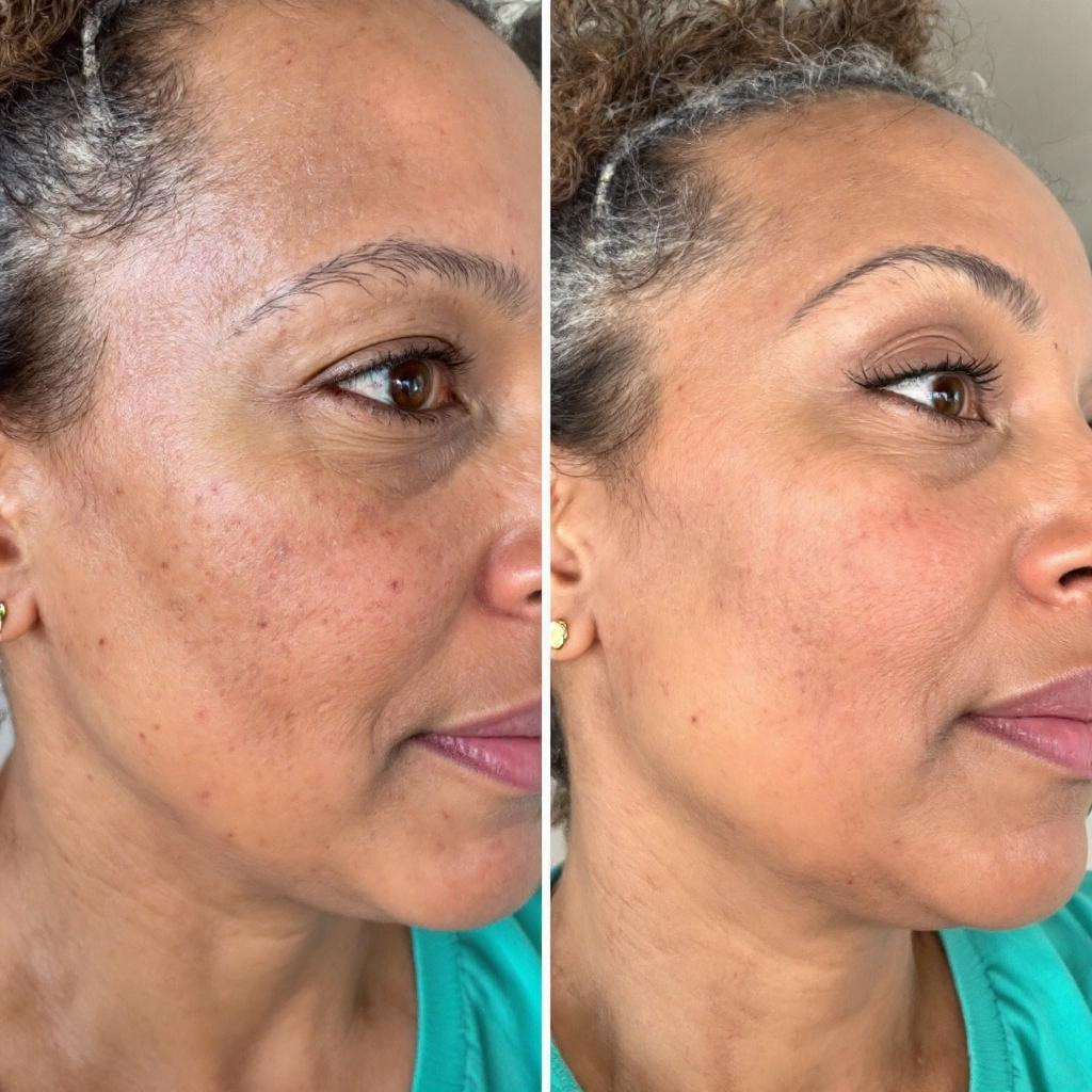 “Radiance Ready” Turmeric & Green Tea Face Cleanser