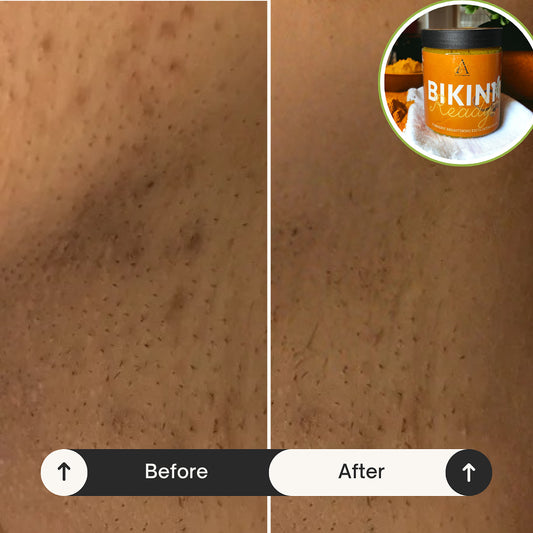 “Bikini Ready” Turmeric Fading & Brightening Bikini Scrub