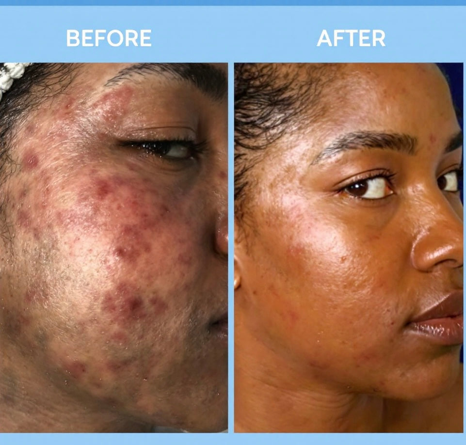 Colloidal Soothing Oatmeal Facial & Soap Bar
