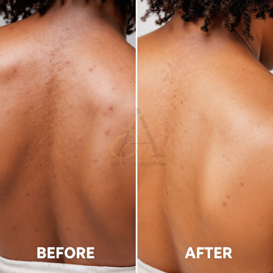 “Body Ready” Turmeric Fading & Brightening Body Wash