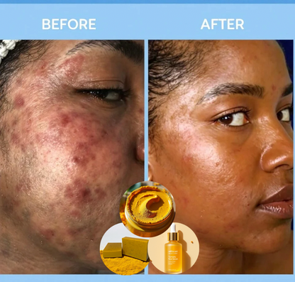 Dark Marks Eraser Kit