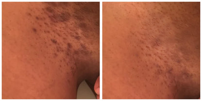 Dark Marks Eraser Kit