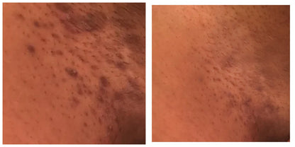 “Target Ready” Fade Balm for Neck, Elbows, Knees & Inner Thighs