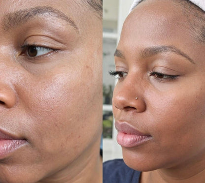 Superfruit Hydrating & Brightening Facial Serum