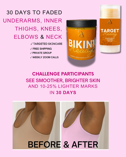 30 Day Dark Mark Fading Challenge