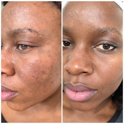 Dark Marks Eraser Kit