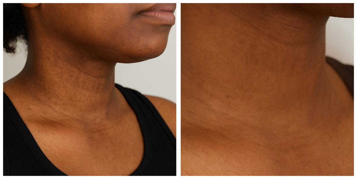 “Target Ready” Fade Balm for Neck, Elbows, Knees & Inner Thighs