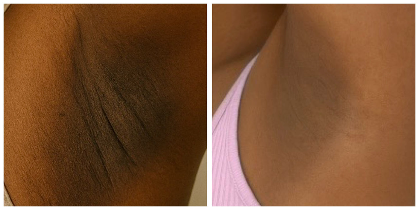 “Target Ready” Fade Balm for Neck, Elbows, Knees & Inner Thighs