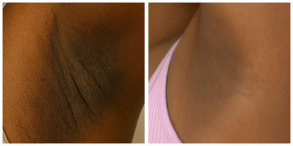 “Target Ready” Fade Balm for Neck, Elbows, Knees & Inner Thighs