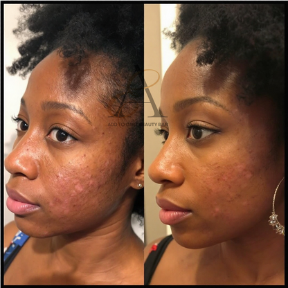 Turmeric & Green Tea Repair Face Serum