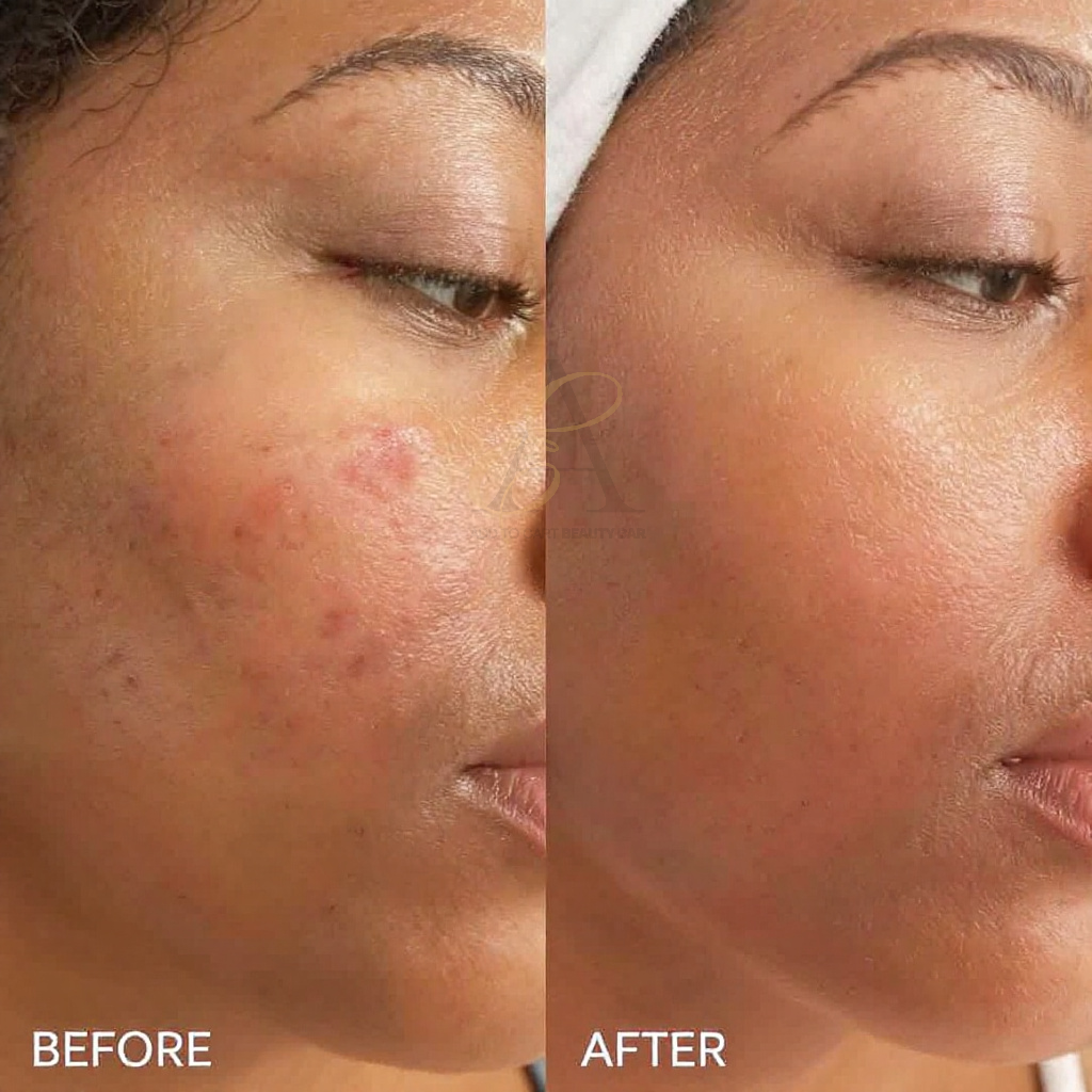 Turmeric & Green Tea Repair Face Serum